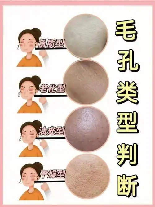 毛孔的类型