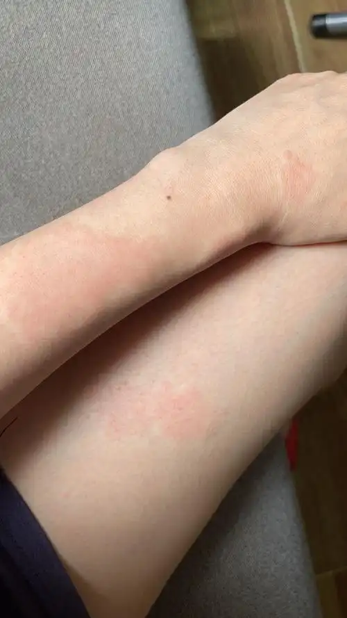 这是什么呀,能用药吗