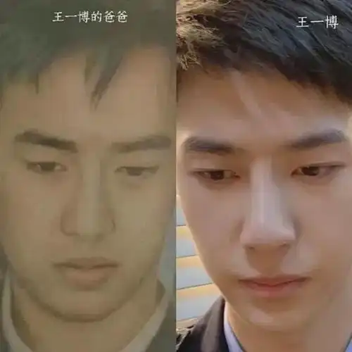 一部追风者王一博被抓住了小把柄这下整容实锤了
