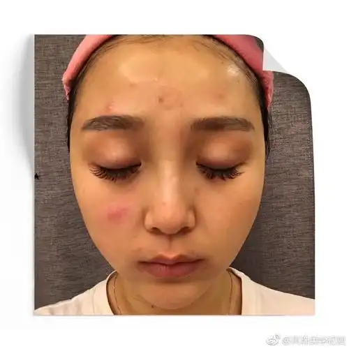 熬夜皮肤差怎么办 这些一定一定要注意