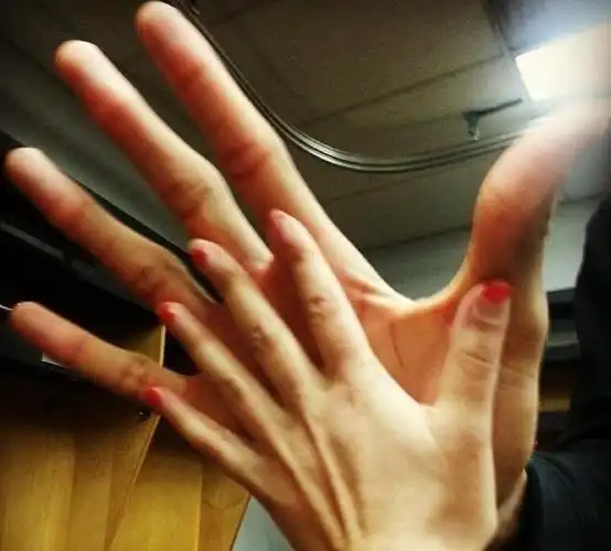 世界上手最大的人,苏尔坦·科森