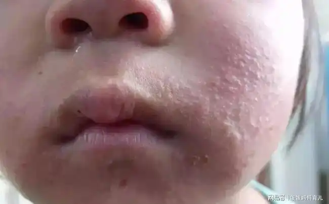 夏季,孩子吃水果有讲究,这几种水果不能多吃,你别傻傻的天天买|芒果