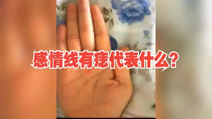 感情线有痣代表什么?