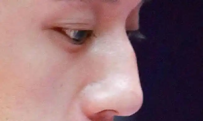 驼峰鼻的男人命运好吗会发财吗