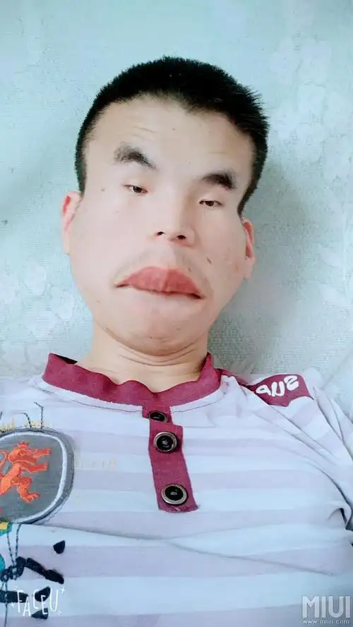 丑小男