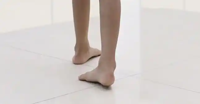 矫正鞋这样穿能为内八字宝宝带来干预效果