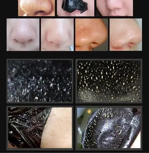 米雅诗 去黑头面膜撕拉式黑头导出液男女士清洁面部草莓鼻子吸粉刺鼻