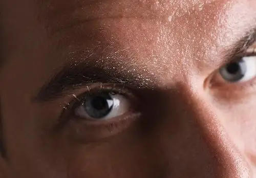 男生毛孔粗大四大解决办法第1页:男生毛孔粗大四大解决办法第1页:男生