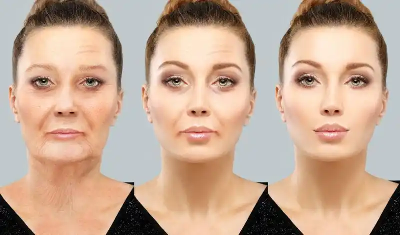 女性面部皮肤问题