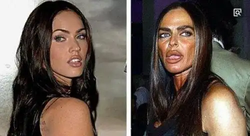 盘点世界十大最可怕的整容失败案例你还敢在脸上动刀子吗2