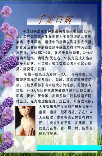 703海报印制展板写真喷绘素材220儿童疾病防接种之手足口病知识