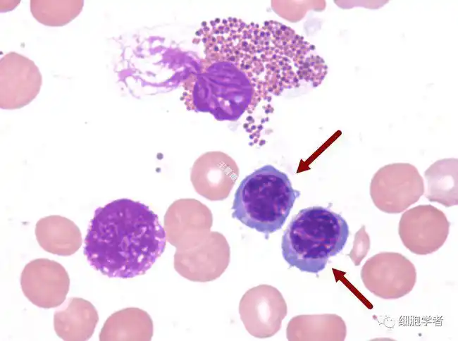 中幼红细胞   13