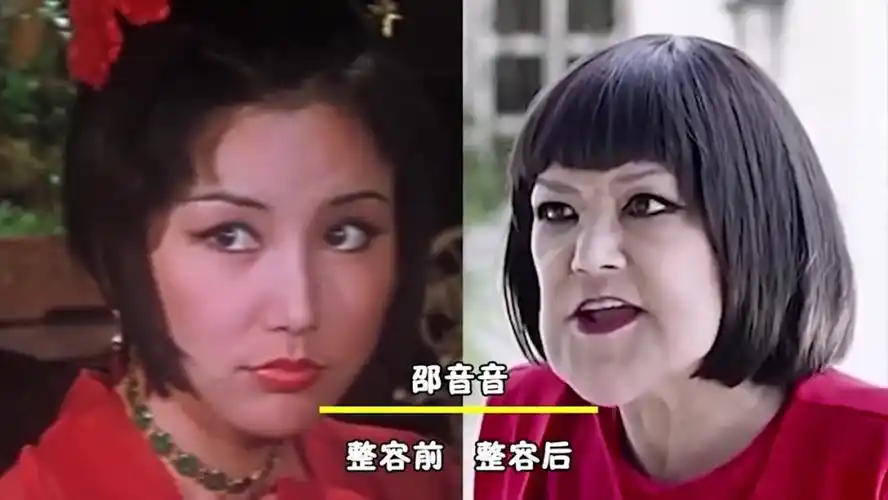 如今的邵音音已经71岁了,虽然整容后遗症使自己变成了"怪物",但是现在