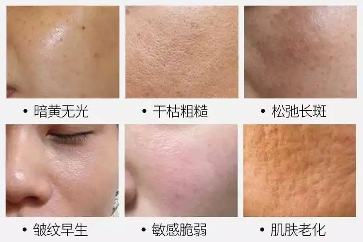 皮肤毒素堆积的症状