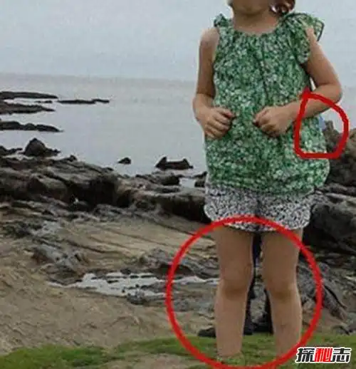 日本真实灵异事件贝冢结核病医院不要随便进网友杜撰