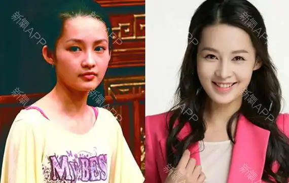 韩国欧佩拉整形外科