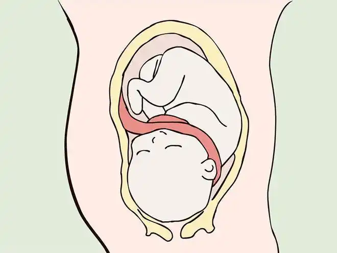 胎儿臀位且脐带绕颈2周,能顺产吗?|分娩|子宫|胎位_网易订阅
