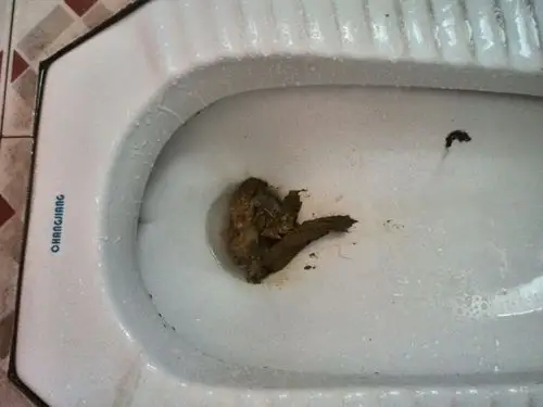 最近半月有一两次大便带点黑请问是正常过吗