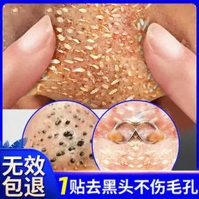 去黑头鼻贴收缩毛孔粉刺深层清洁鼻子祛闭口导出液神器男女士专用