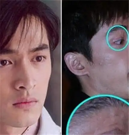 【图】胡歌车祸前照片对比惊人 揭男神出事的诡秘内幕