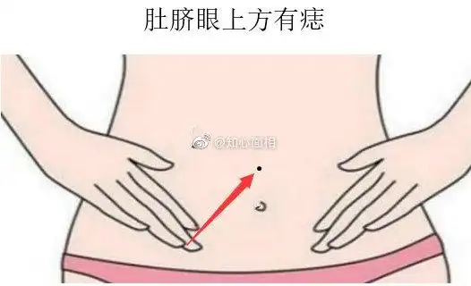 女生肚子上有痣是很有福气的,特别是长在肚脐眼上位置的痣,一定有着