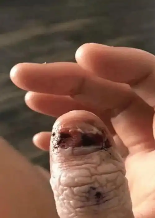 2,把指甲养起来,让孩子"不舍得咬"