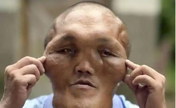 世界上脑袋最大的人长相奇特怪异网友不淡定了