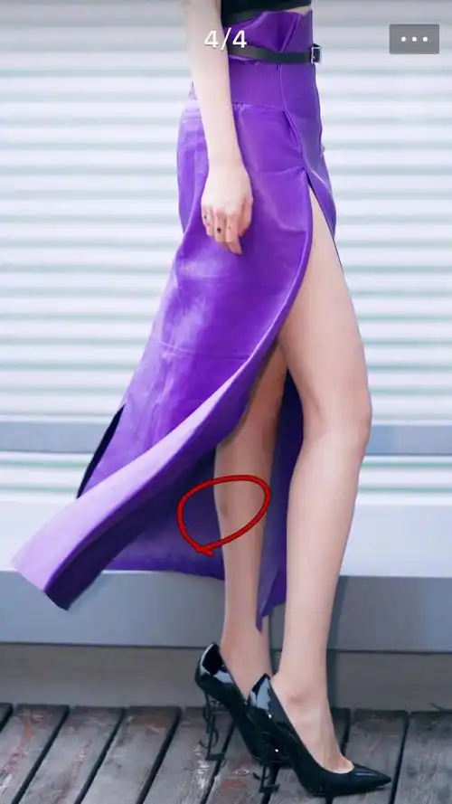 听说有胎记的宝宝,都不会弄丢,胎记就是上辈子上帝在宝宝身上留下的