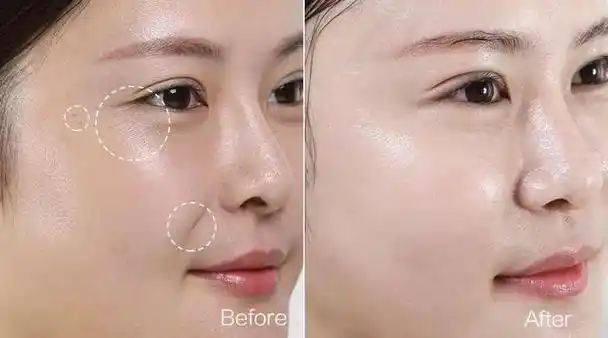 激光美白,照片对比,感受神奇魅力!