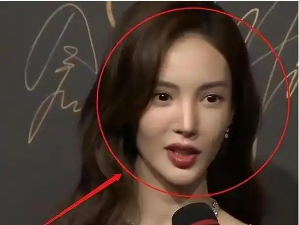 金晨嘴巴不歪了鼻子不假了娱乐圈又多一个天然美女