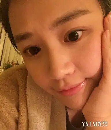 【图】马思纯素颜照嘴唇水润饱满 秋冬唇部护理小技巧揭秘