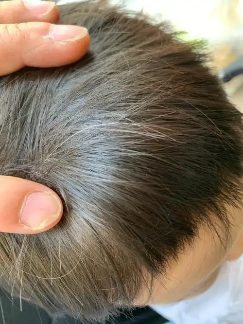 一周五女宝有一根白头发