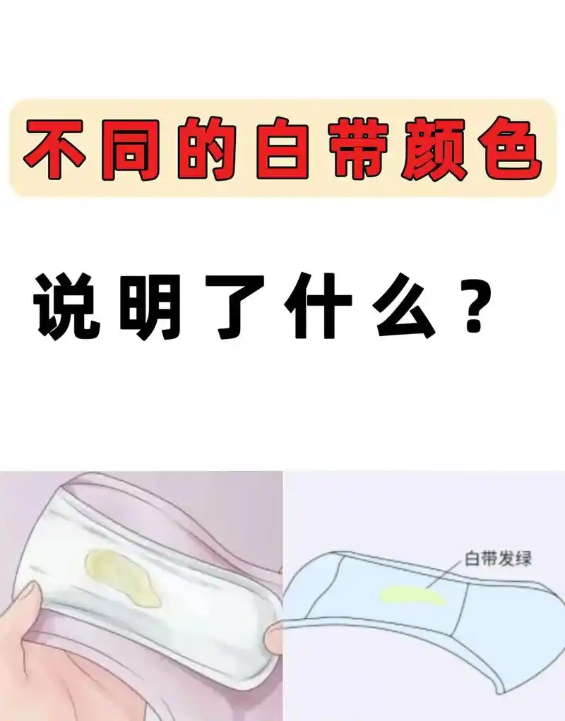 不同的白带颜色说明了什么?各位女性朋友们要注意了#妇科知识  - 抖音