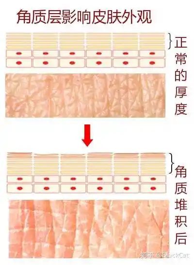 再来了解什么是角质层?