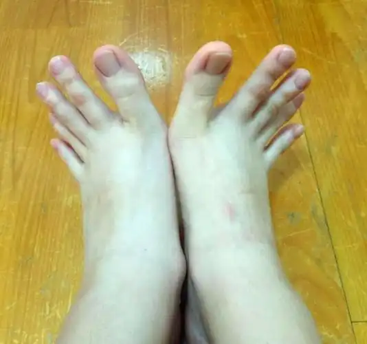 农村俗语"二拇脚趾头长,长大了不养娘",从脚趾真能看出人品?