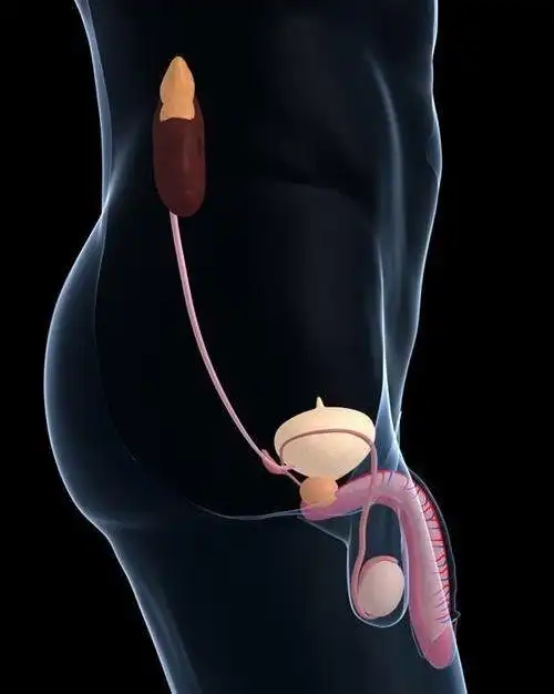 精索曲张睾丸下坠时图片 (9)