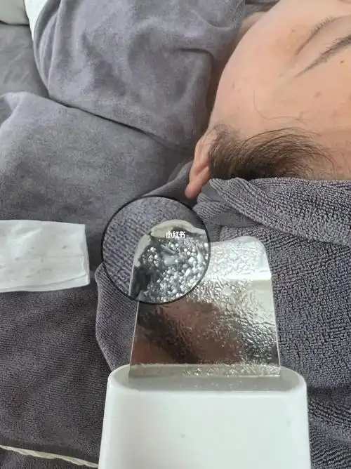 小气泡深层清洁