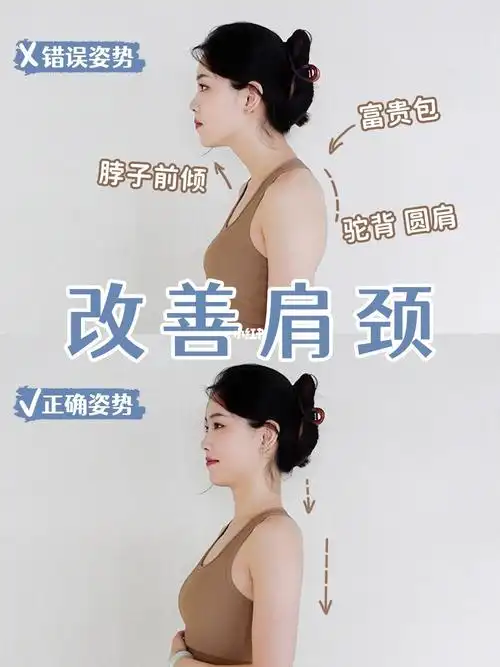 亲测有效三招改善脖前倾富贵包