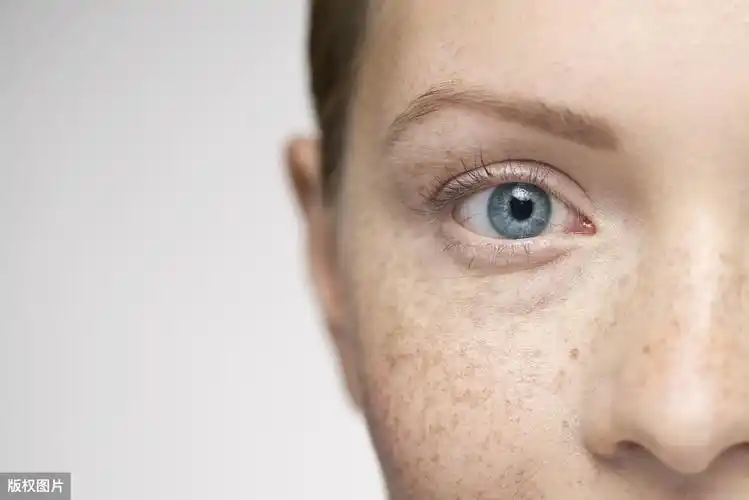 皮肤科老中医:脸上长斑主要是这两大原因引起的,这个穴位可淡斑
