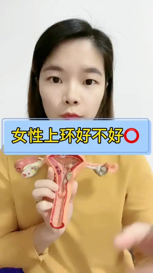 女性上环好不好?
