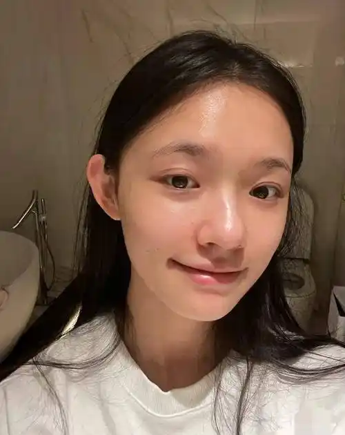 加上是纯素颜的原因,林允脸上的痘痘等小瑕疵也看得非常清楚.