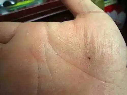 手相是先天而成,后天也能改善,但效果不是很明显.