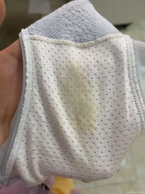 做完宫腔镜分泌物这样正常吗