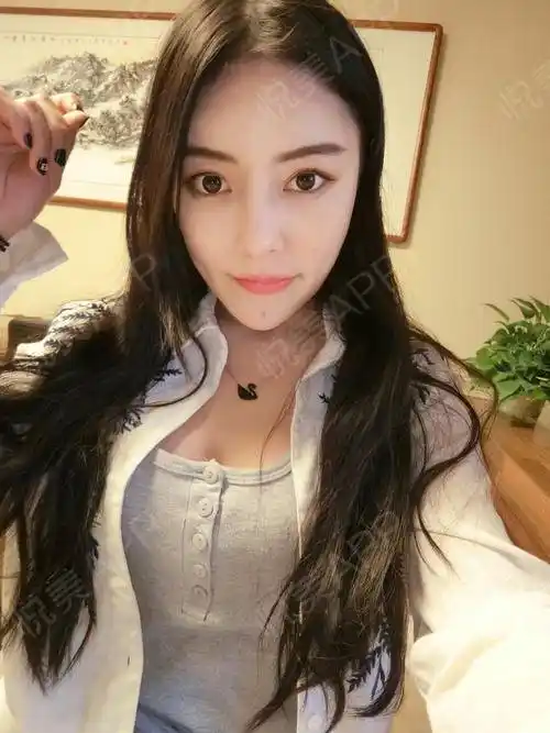 自体脂肪隆胸术后15天_其他填充术后15天_隆胸术后15天_自体脂肪术后