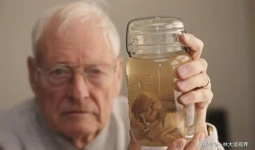 原创爱因斯坦的大脑和毛发还保留着现代科技能克隆出爱因斯坦吗