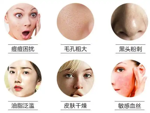 酵母卵壳面纱霜,补水滋润提拉紧致,一瓶解决六大肌肤问题