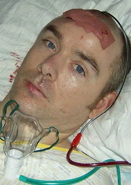 被枪爆头是怎样一种体验?