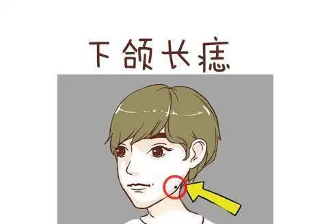 同时,下颌长痣,代表着主要为白手起家.