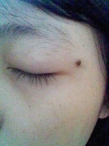 我想知道脸上那些痣需要点,懂面相的进来