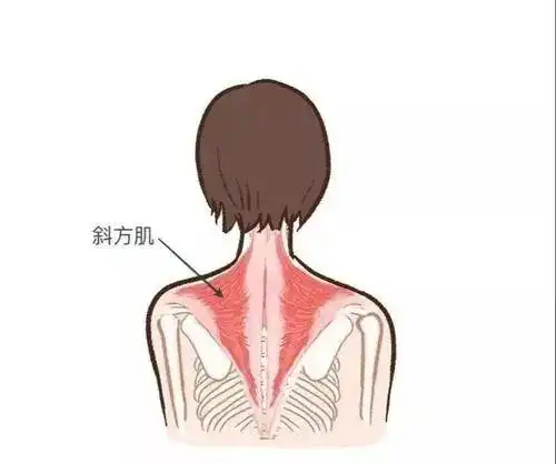 斜方肌新解事关颜值肩颈健康的肌肉